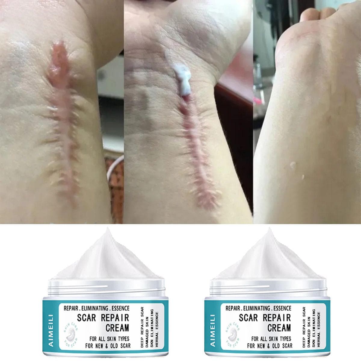 Scar Removal Essential Oil Ultra Premium Compound Essential Oils for Massage Face Body Skin Care Scars Repair Acne Burn