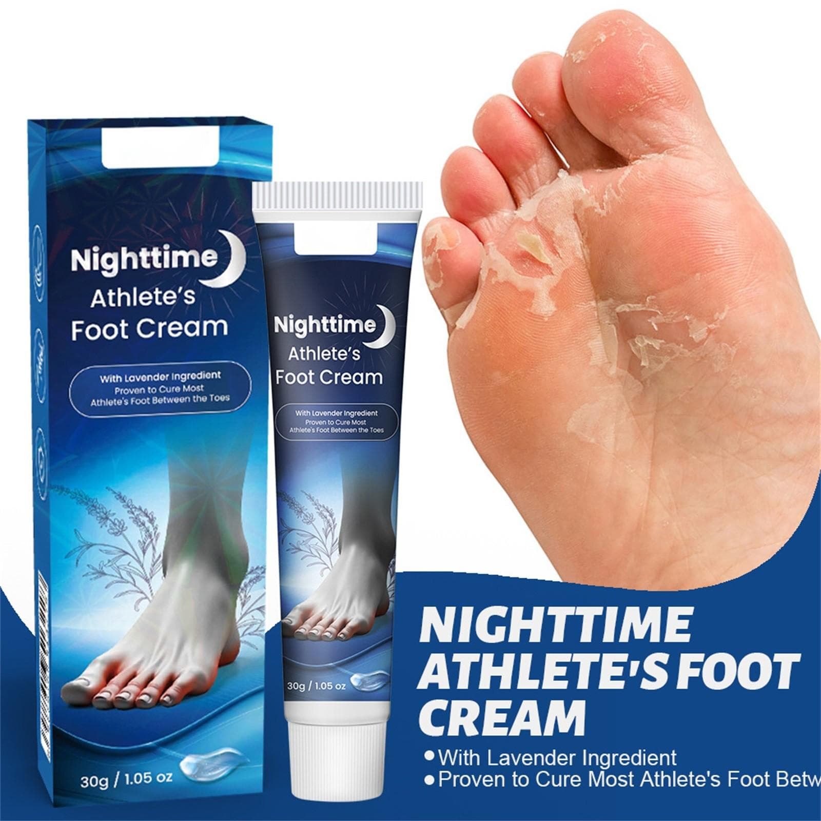 Athlete's Foot Care Cream Remove Feet Odor Itch Ointment Beriberi Foot Peeling Plaster30g